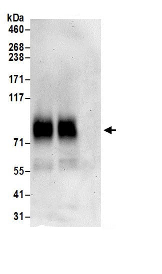 Immunoprecipitation:SLC7A2 AntibodyNBP3-29716] -Detection of human CAT2 by western blot of immunoprecipitates. Samples: Whole cell lysate (1 mg for IP; 20% of IP loaded) prepared using NETN buffer from HeLa cells. Antibodies: Affinity purified rabbit anti-CAT2 antibody NBP3-29716 (lot NBP3-29716-1) used for IP at 6 µg per reaction. CAT2 was also immunoprecipitated by rabbit anti-CAT2 antibody for blotting immunoprecipitated CAT2, NBP3-29716 was used at 1 µg/ml. Detection: Chemiluminescence with an exposure time of 3 minutes.