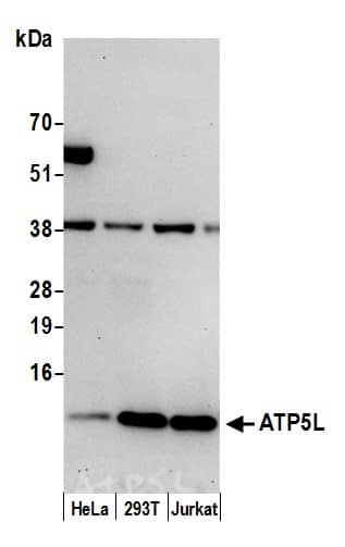 Western Blot:[NBP3-29720]-Detection of human ATP5L by western blot. Samples: Whole cell lysate from HeLa, HEK293T, and Jurkat cells prepared using NETN lysis buffer. Antibody: Affinity purified rabbit anti-ATP5L antibody used for WB at 0. 1 µg/ml. Detection: Chemiluminescence with an exposure time of 30 seconds.