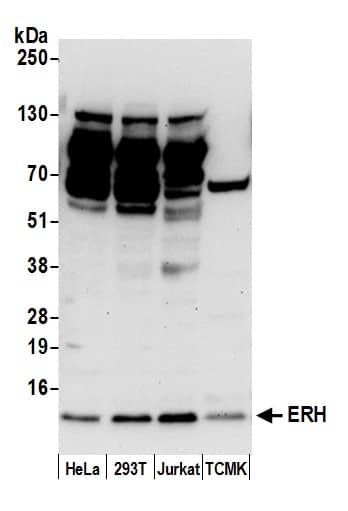 Western Blot:[NBP3-29721]-Detection of human and mouse ERH by western blot. Samples: Whole cell lysate from HeLa, HEK293T, Jurkat, and mouse TCMK-1 cells prepared using NETN lysis buffer. Antibody: Affinity purified rabbit anti-ERH antibody used for WB at 0. 1 µg/ml. Detection: Chemiluminescence with an exposure time of 30 seconds.