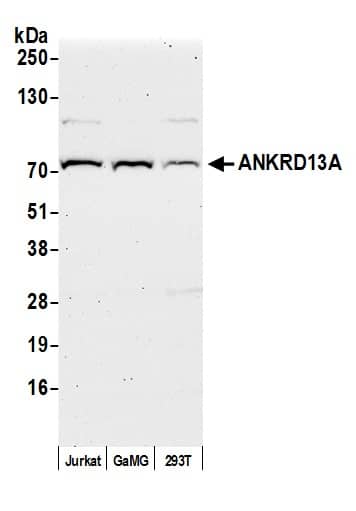 Western Blot:[NBP3-29722]-Detection of human by western blot. Samples: Whole cell lysate from Jurkat, GaMG, and HEK293T cells prepared using NETN lysis buffer. Antibody: Affinity purified Rabbit antibody used for WB at 0. 1 mg/ml. Detection: Chemiluminescence with an exposure time of 75 seconds.