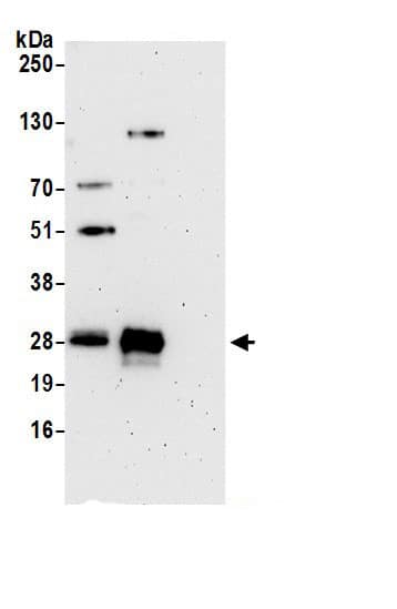 Immunoprecipitation:STARD3NL AntibodyNBP3-29724] -Detection of human STARD3NL by western blot of immunoprecipitates. Samples: Whole cell lysate (0.5 or 1.0 mg per IP reaction; 20% of IP loaded) from 293T cells prepared using NETN lysis buffer. Antibodies: Affinity purified rabbit anti-STARD3NL antibody NBP3-29724 (lot NBP3-29724-1) used for IP at 6 µg per reaction. STARD3NL was also immunoprecipitated by rabbit anti-STARD3NL antibody. For blotting immunoprecipitated STARD3NL, NBP3-29724 was used at 1 µg/ml. Detection: Chemiluminescence with an exposure time of 3 minutes.
