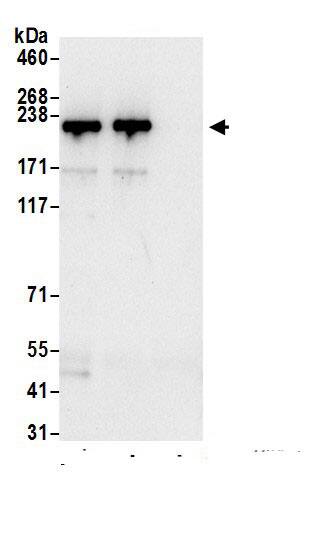 Immunoprecipitation:Myosin Heavy Chain AntibodyNBP3-29725] -Detection of human MYH14 by western blot of immunoprecipitates. Samples: Whole cell lysate (0.5 or 1.0 mg per IP reaction; 20% of IP loaded) from 293T cells prepared using NETN lysis buffer. Antibodies: Affinity purified rabbit anti-MYH14 antibody NBP3-29725 (lot NBP3-29725-1) used for IP at 6 µg per reaction. MYH14 was also immunoprecipitated by rabbit anti-MYH14.. For blotting immunoprecipitated MYH14, NBP3-29725 was used at 1 µg/ml. Detection: Chemiluminescence with an exposure time of 10 seconds.