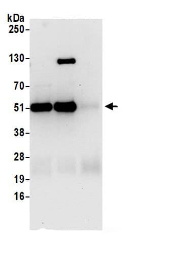 Immunoprecipitation:Nesfatin-1/Nucleobindin-2 AntibodyNBP3-29729] -Detection of human NUCB2 by western blot of immunoprecipitates. Samples: Whole cell lysate (0.5 or 1.0 mg per IP reaction; 20% of IP loaded) from Jurkat cells prepared using NETN lysis buffer. Antibodies: Affinity purified rabbit anti-NUCB2 antibody NBP3-29729 (lot NBP3-29729-1) used for IP at 6 µg per reaction. NUCB2 was also immunoprecipitated by rabbit anti-NUCB2.. For blotting immunoprecipitated NUCB2, NBP3-29729 was used at 1 µg/ml. Detection: Chemiluminescence with an exposure time of 30 seconds.