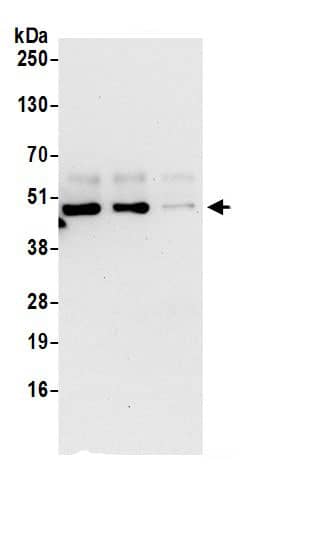 Immunoprecipitation:P2X5/P2RX5 AntibodyNBP3-29730] -Detection of human P2RX5 by western blot of immunoprecipitates. Samples: Whole cell lysate (1 mg for IP; 20% of IP loaded) prepared using NETN buffer from HeLa cells. Antibodies: Affinity purified rabbit anti-P2RX5 antibody NBP3-29730 (lot NBP3-29730-1) used for IP at 6 µg per reaction. P2RX5 was also immunoprecipitated by rabbit anti-P2RX5 antibody BL16575. For blotting immunoprecipitated P2RX5, NBP3-29730 was used at 0.1 µg/ml. Detection: Chemiluminescence with an exposure time of 30 seconds.