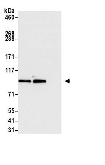 Immunoprecipitation:BICD2 AntibodyNBP3-29731] -Detection of human BICD2 by western blot of immunoprecipitates. Samples: Whole cell lysate (1.0 mg per IP reaction; 20% of IP loaded) from HEK293T cells prepared using NETN lysis buffer. Antibodies: Affinity purified rabbit anti-BICD2 antibody NBP3-29731 (lot NBP3-29731-3) used for IP at 6 µg per reaction. BICD2 was also immunoprecipitated by a previous lot of this antibody (lot NBP3-29731-2). For blotting immunoprecipitated BICD2, NBP3-29731 was used at 0.04 µg/ml. Detection: Chemiluminescence with an exposure time of 3 seconds.
