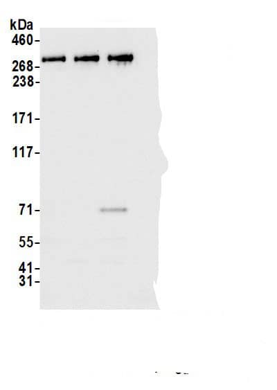 Immunoprecipitation:KAT4/TBP Associated Factor 1 AntibodyNBP3-29732] -Detection of human TAF1 by western blot of immunoprecipitates. Samples: Whole cell lysate (1.0 mg per IP reaction; 20% of IP loaded) from HEK293T cells prepared using NETN lysis buffer. Antibodies: Affinity purified rabbit anti-TAF1 antibody NBP3-29732 lot 3 used for IP at 6 µg per reaction. TAF1 was also immunoprecipitated by a previous lot of this antibody (NBP3-29732 lot 2) and rabbit anti-TAF1 antibody (A303-505A). For blotting immunoprecipitated TAF1, NBP3-29732 was used at 0.04 µg/ml. Detection: Chemiluminescence with an exposure time of 3 seconds.