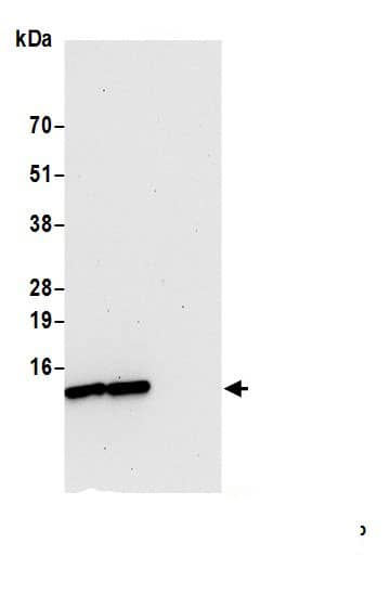 Immunoprecipitation:VMA21 AntibodyNBP3-29735] -Detection of human VMA21 by western blot of immunoprecipitates. Samples: Whole cell lysate (0.5 or 1.0 mg per IP reaction; 20% of IP loaded) from 293T cells prepared using NETN lysis buffer. Antibodies: Affinity purified rabbit anti-VMA21 antibody (NBP3-29735 lot 1) used for IP at 2 µg per reaction. VMA21 was also immunoprecipitated by rabbit anti-VMA21.. For blotting immunoprecipitated VMA21, NBP3-29735 was used at 0.1 mg/ml. Detection: Chemiluminescence with an exposure time of 30 seconds.