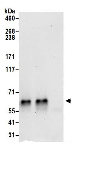 Immunoprecipitation DAGLB Antibody - BSA Free