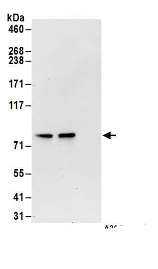 Immunoprecipitation:Transglutaminase 2/TGM2 AntibodyNBP3-29740] -Detection of human TG2 by western blot of immunoprecipitates. Samples: Whole cell lysate (1 mg for IP; 20% of IP loaded) from HeLa cells. Antibodies: Affinity purified rabbit anti-TG2 antibody NBP3-29740 (lot NBP3-29740-1) used for IP at 6 µg/mg lysate. TG2 was also immunoprecipitated by rabbit anti-TG2.. For blotting immunoprecipitated TG2, NBP3-29740 was used at 0.1 µg/ml. Detection: Chemiluminescence with an exposure time of 30 seconds.