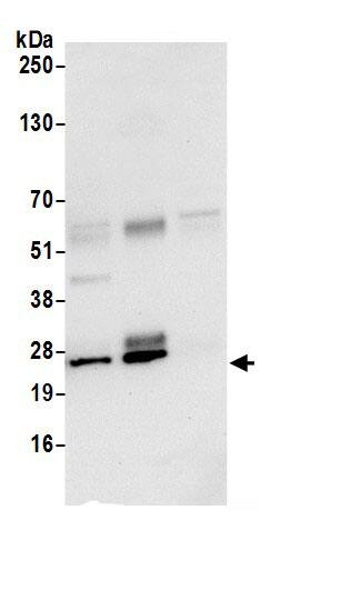 Immunoprecipitation:REXO2 AntibodyNBP3-29741] -Detection of human REXO2 by western blot of immunoprecipitates. Samples: Whole cell lysate (0.5 or 1.0 mg per IP reaction; 20% of IP loaded) from 293T cells prepared using NETN lysis buffer. Antibody: Affinity purified rabbit anti-REXO2 antibody NBP3-29741 (lot NBP3-29741-1) used for IP at 6 µg per reaction. REXO2 was also immunoprecipitated by rabbit anti-REXO2 antibody . For blotting immunoprecipitated REXO2, NBP3-29741 was used at 1 µg/ml. Detection: Chemiluminescence with an exposure time of 10 seconds.