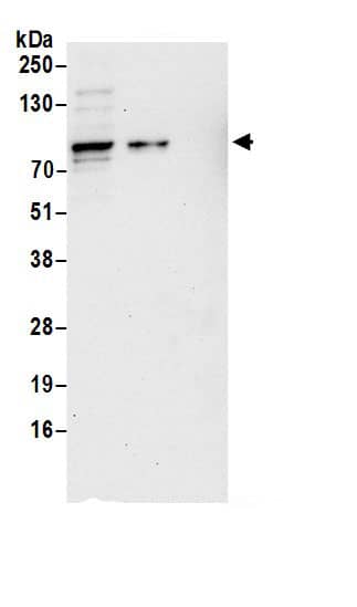 Immunoprecipitation:Epsin 1 AntibodyNBP3-29744] -Detection of human Epsin 1 by western blot of immunoprecipitates. Samples: Whole cell lysate (0.5 or 1.0 mg per IP reaction; 20% of IP loaded) from 293T cells prepared using NETN lysis buffer. Antibodies: Affinity purified rabbit anti-Epsin 1 antibody NBP3-29744 (lot NBP3-29744-1) used for IP at 6 µg per reaction. Epsin 1 was also immunoprecipitated by rabbit anti-Epsin 1.. For blotting immunoprecipitated Epsin 1, NBP3-29744 was used at 1 µg/ml. Detection: Chemiluminescence with an exposure time of 30 seconds.