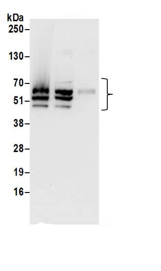 Immunoprecipitation:PPAN AntibodyNBP3-29745] -Detection of human PPAN by western blot of immunoprecipitates. Samples: Whole cell lysate (0.5 or 1.0 mg per IP reaction; 20% of IP loaded) from HeLa cells prepared using NETN lysis buffer. Antibodies: Affinity purified rabbit anti-PPAN antibody NBP3-29745 (lot NBP3-29745-1) used for IP at 6 µg per reaction. PPAN was also immunoprecipitated by rabbit anti-PPAN antibody BL17358. For blotting immunoprecipitated PPAN, NBP3-29745 was used at 1 µg/ml. Detection: Chemiluminescence with an exposure time of 10 seconds.