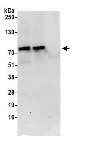 Immunoprecipitation:PPIL4 AntibodyNBP3-29746] -Detection of human PPIL4 by western blot of immunoprecipitates. Samples: Whole cell lysate (0.5 or 1.0 mg per IP reaction; 20% of IP loaded) from HeLa cells prepared using NETN lysis buffer. Antibodies: Affinity purified rabbit anti-PPIL4 antibody NBP3-29746 (lot NBP3-29746-1) used for IP at 6 µg per reaction. PPIL4 was also immunoprecipitated by rabbit anti-PPIL4.. For blotting immunoprecipitated PPIL4, NBP3-29746 was used at 1 µg/ml. Detection: Chemiluminescence with an exposure time of 30 seconds.