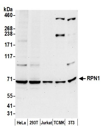 Western Blot:[NBP3-29747]-Detection of human and mouse RPN1 by western blot. Samples: Whole cell lysate from HeLa, HEK293T, Jurkat, mouse TCMK-1, and mouse NIH 3T3 cells prepared using NETN lysis buffer. Antibody: Affinity purified rabbit anti-RPN1 antibody used for WB at 0. 4 µg/ml. Detection: Chemiluminescence with an exposure time of 30 seconds.