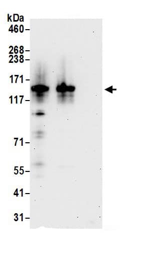 Immunoprecipitation:ADAR AntibodyNBP3-29751] -Detection of human ADAR1 by western blot of immunoprecipitates. Samples: Whole cell lysate (1.0 mg per IP reaction; 20% of IP loaded) from HEK293T cells prepared using NETN lysis buffer. Antibodies: Affinity purified rabbit anti-ADAR1 antibody NBP3-29751 (lot NBP3-29751-3) used for IP at 3 µg per reaction. ADAR1 was also immunoprecipitated by rabbit anti-ADAR1.. For blotting immunoprecipitated ADAR1, NBP3-29751 was used at 0.4 µg/ml. Detection: Chemiluminescence with an exposure time of 30 seconds.