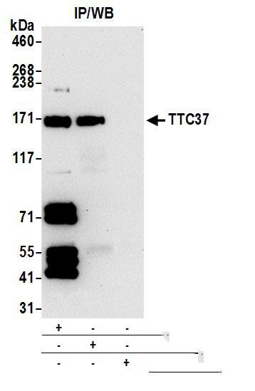Immunoprecipitation:[NBP3-29754]-Detection of human TTC37 by western blot of immunoprecipitates. Samples: Whole cell lysate from GaMG cells prepared using NETN lysis buffer. Antibodies: Rabbit anti-TTC37 antibody used for IP at 2 µg per reaction. TTC37 was also immunoprecipitated by rabbit anti-TTC37 antibody. For blotting immunoprecipitated TTC37, was used at 0. 1 mg/ml. Detection: Chemiluminescence with an exposure time of 30 seconds.