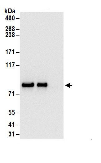 Immunoprecipitation:Glycogen Synthase AntibodyNBP3-29755] -Detection of human GYS1 by western blot of immunoprecipitates. Samples: Whole cell lysate (1 mg for IP; 20% of IP loaded) from 293T cells. Antibodies: Affinity purified rabbit anti-GYS1 antibody NBP3-29755 (lot NBP3-29755-1) used for IP at 6 µg/mg lysate. GYS1 was also immunoprecipitated by rabbit anti-GYS1.. For blotting immunoprecipitated GYS1, NBP3-29755 was used at 1 µg/ml. Detection: Chemiluminescence with an exposure time of 3 seconds.