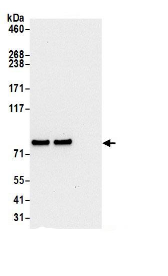 Immunoprecipitation:LETM1 AntibodyNBP3-29757] -Detection of human LETM1 by western blot of immunoprecipitates. Samples: Whole cell lysate (0.5 or 1.0 mg per IP reaction; 20% of IP loaded) from 293T cells prepared using NETN lysis buffer. Antibodies: Affinity purified rabbit anti-LETM1 antibody NBP3-29757 (lot NBP3-29757-1) used for IP at 6 µg per reaction. LETM1 was also immunoprecipitated by rabbit anti-LETM1 antibody BL21967. For blotting immunoprecipitated LETM1, NBP3-29757 was used at 0.4 µg/ml. Detection: Chemiluminescence with an exposure time of 10 seconds.