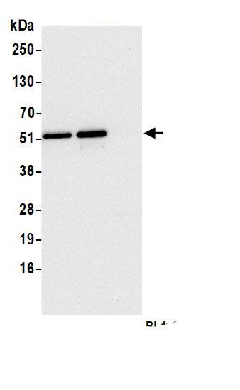 Immunoprecipitation:RPL4 AntibodyNBP3-29762] -Detection of human RPL4 by western blot of immunoprecipitates. Samples: Whole cell lysate (1.0 mg per IP reaction; 20% of IP loaded) from HeLa cells prepared using NETN lysis buffer. Antibodies: Affinity purified rabbit anti-RPL4 antibody (NBP3-29762 lot 1) used for IP at 6 µg per reaction. RPL4 was also immunoprecipitated by a second. a different epitope of RPL4. For blotting immunoprecipitated RPL4, NBP3-29762 was used at 0.1 µg/ml. Detection: Chemiluminescence with an exposure time of 3 seconds.