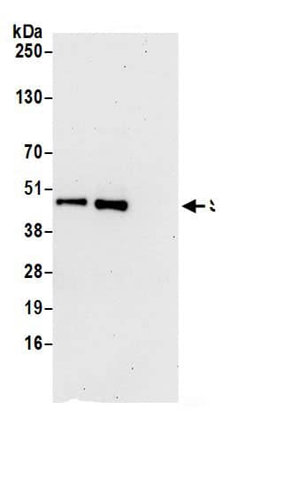 Immunoprecipitation:SUCLG2 AntibodyNBP3-29763] -Detection of human SUCLG2 by western blot of immunoprecipitates. Samples: Whole cell lysate (0.5 or 1.0 mg per IP reaction; 20% of IP loaded) from 293T cells prepared using NETN lysis buffer. Antibodies: Affinity purified rabbit anti-SUCLG2 antibody NBP3-29763 (lot NBP3-29763-1) used for IP at 6 µg per reaction. SUCLG2 was also immunoprecipitated by rabbit anti-SUCLG2.. For blotting immunoprecipitated SUCLG2, NBP3-29763 was used at 1 µg/ml. Detection: Chemiluminescence with an exposure time of 30 seconds.