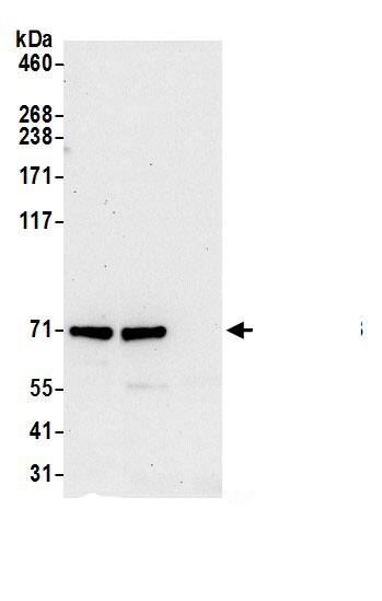 Immunoprecipitation:TJP3 AntibodyNBP3-29765] -Detection of human TJP3/ZO-3 by western blot of immunoprecipitates. Samples: Whole cell lysate (0.5 or 1.0 mg per IP reaction; 20% of IP loaded) from Jurkat cells prepared using NETN lysis buffer. Antibodies: Affinity purified rabbit anti-TJP3/ZO-3 antibody NBP3-29765 (lot NBP3-29765-1) used for IP at 6 µg per reaction. TJP3/ZO-3 was also immunoprecipitated by rabbit anti-TJP3/ZO-3.. For blotting immunoprecipitated TJP3/ZO-3, NBP3-29765 was used at 1 µg/ml. Detection: Chemiluminescence with an exposure time of 30 seconds.