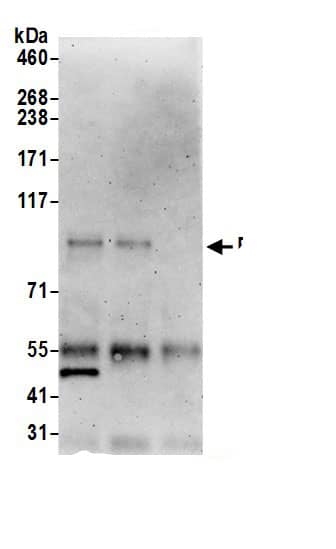 Immunoprecipitation:PEG10 AntibodyNBP3-29766] -Detection of human PEG10 by western blot of immunoprecipitates. Samples: Whole cell lysate (0.5 or 1.0 mg per IP reaction; 20% of IP loaded) from HeLa cells prepared using NETN lysis buffer. Antibodies: Affinity purified rabbit anti-PEG10 antibody NBP3-29766 (lot NBP3-29766-1) used for IP at 6 µg per reaction. PEG10 was also immunoprecipitated by rabbit anti-PEG10 antibody BL19935. For blotting immunoprecipitated PEG10, NBP3-29766 was used at 0.4 µg/ml. Detection: Chemiluminescence with an exposure time of 3 minutes.