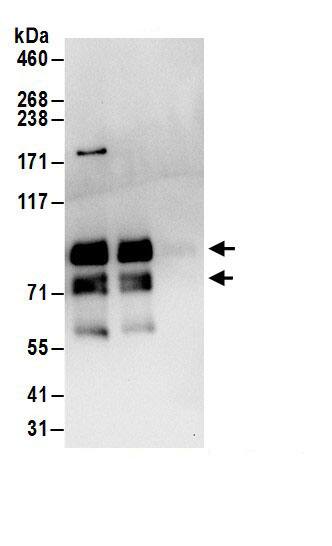 Immunoprecipitation:MEPCE AntibodyNBP3-29769] -Detection of human MEPCE by western blot of immunoprecipitates. Samples: Whole cell lysate (1 mg for IP; 20% of IP loaded) from 293T cells. Antibodies: Affinity purified rabbit anti-MEPCE antibody NBP3-29769 (lot NBP3-29769-1) used for IP at 6 µg/mg lysate. MEPCE was also immunoprecipitated by rabbit anti-MEPCE.. For blotting immunoprecipitated MEPCE, NBP3-29769 was used at 1 µg/ml. Detection: Chemiluminescence with an exposure time of 10 seconds.