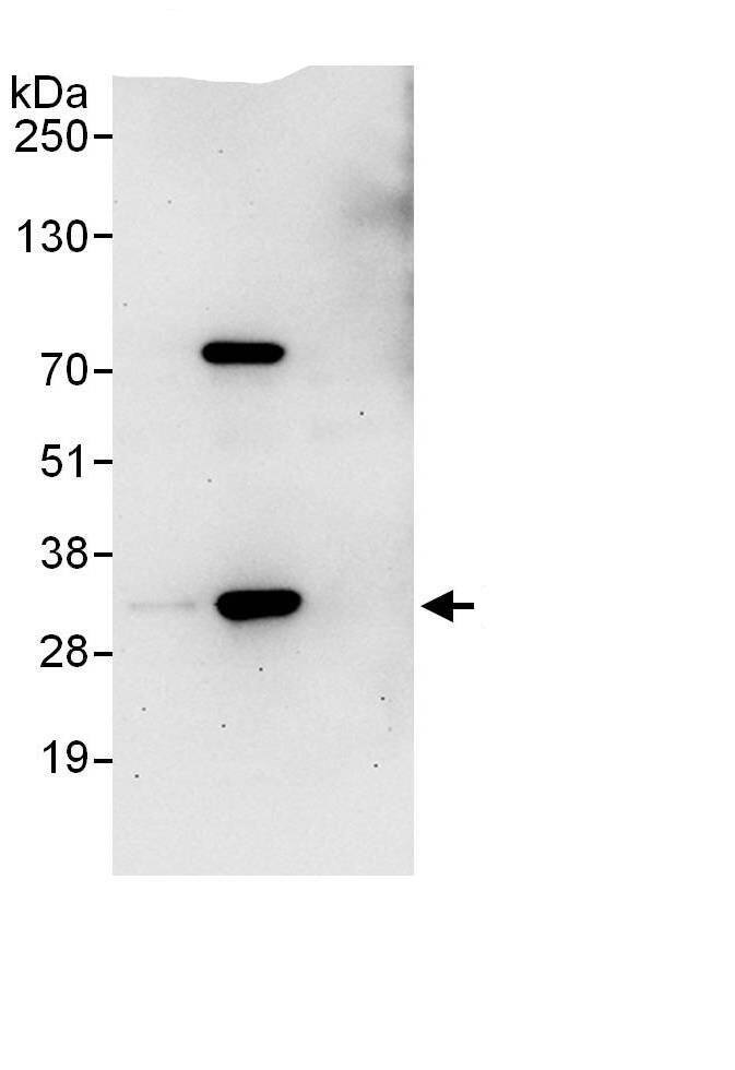 Immunoprecipitation:PSMA1 AntibodyNBP3-29771] -Detection of human PSMA1 by western blot of immunoprecipitates. Samples: Whole cell lysate (1 mg for IP; 20% of IP loaded) from HEK293T cells. Antibodies: Affinity purified rabbit anti-PSMA1 antibody NBP3-29771 (lot NBP3-29771-1) used for IP at 6 µg/mg lysate. PSMA1 was also immunoprecipitated, albeit at low efficiency, by rabbit anti-PSMA1.. For blotting immunoprecipitated PSMA1, NBP3-29771 was used at 1 µg/ml. Detection: Chemiluminescence with an exposure time of 30 seconds.