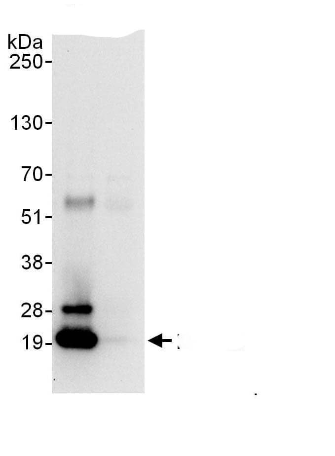 Immunoprecipitation:PSMB5 AntibodyNBP3-29772] -Detection of human PSMB5 by western blot of immunoprecipitates. Samples: Whole cell lysate (1 mg for IP; 20% of IP loaded) from HEK293T cells. Antibodies: Affinity purified rabbit anti-PSMB5 antibody NBP3-29772 (lot NBP3-29772-1) used for IP at 6 µg/mg lysate. For blotting immunoprecipitated PSMB5, was used at 1 µg/ml. Detection: Chemiluminescence with an exposure time of 30 seconds.