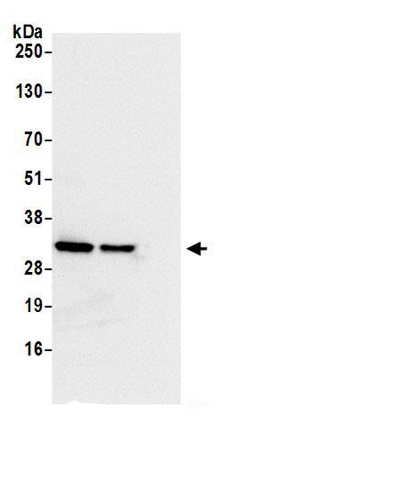 Immunoprecipitation:RPS3A AntibodyNBP3-29773] -Detection of human Ribosomal Protein S3A by western blot of immunoprecipitates. Samples: Whole cell lysate (0.5 or 1.0 mg per IP reaction; 20% of IP loaded) from 293T cells. Antibodies: Affinity purified rabbit anti-Ribosomal Protein S3A antibody NBP3-29773 (lot NBP3-29773-1) used for IP at 6 µg per reaction. Ribosomal Protein S3A was also immunoprecipitated by rabbit anti-Ribosomal Protein S3A.. For blotting immunoprecipitated Ribosomal Protein S3A, NBP3-29773 was used at 1 µg/ml. Detection: Chemiluminescence with an exposure time of 3 seconds.