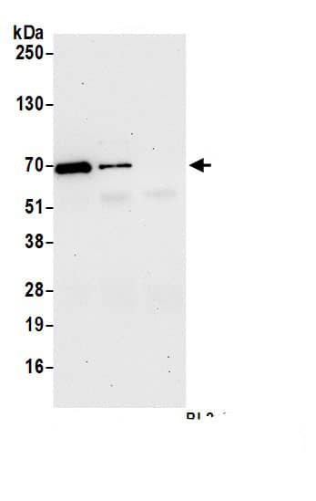 Immunoprecipitation:Ubiquilin 1 AntibodyNBP3-29774] -Detection of human UBQLN1 by western blot of immunoprecipitates. Samples: Whole cell lysate (1.0 mg per IP reaction; 20% of IP loaded) from MCF-7 cells prepared using NETN lysis buffer. Antibodies: Affinity purified rabbit anti-UBQLN1 antibody (NBP3-29774 lot 1) used for IP at 1 µg per reaction. UBQLN1 was also immunoprecipitated by rabbit anti-UBQLN1 antibody BL20647. For blotting immunoprecipitated UBQLN1, NBP3-29774 was used at 0.04 mg/ml. Detection: Chemiluminescence with an exposure time of 30 seconds.