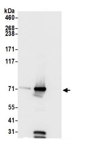 Immunoprecipitation:GRP75/HSPA9B/Mortalin AntibodyNBP3-29778] -Detection of human HSPA9 by western blot of immunoprecipitates. Samples: Whole cell lysate (0.5 or 1.0 mg per IP reaction; 20% of IP loaded) from 293T cells prepared using NETN lysis buffer. Antibodies: Affinity purified rabbit anti-HSPA9 antibody NBP3-29778 (lot NBP3-29778-1) used for IP at 6 µg per reaction. HSPA9 was also immunoprecipitated by rabbit anti-HSPA9 antibody. for blotting immunoprecipitated HSPA9, NBP3-29778 was used at 1 µg/ml. Detection: Chemiluminescence with an exposure time of 1 second.