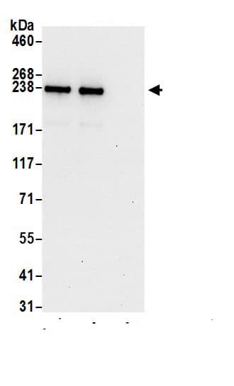 Immunoprecipitation:Myosin Heavy Chain AntibodyNBP3-29780] -Detection of human MYH14 by western blot of immunoprecipitates. Samples: Whole cell lysate (0.5 or 1.0 mg per IP reaction; 20% of IP loaded) from 293T cells prepared using NETN lysis buffer. Antibodies: Affinity purified rabbit anti-MYH14 antibody NBP3-29780 (lot NBP3-29780-1) used for IP at 6 µg per reaction. MYH14 was also immunoprecipitated by rabbit anti-MYH14.. For blotting immunoprecipitated MYH14, NBP3-29780 was used at 1 µg/ml. Detection: Chemiluminescence with an exposure time of 10 seconds.