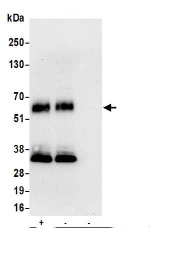 Immunoprecipitation:Lymphotoxin beta R/TNFRSF3 AntibodyNBP3-29782] -Detection of human LTBR by western blot of immunoprecipitates. Samples: Whole cell lysate (0.5 or 1.0 mg per IP reaction; 20% of IP loaded) from HeLa cells prepared using NETN lysis buffer. Antibodies: Affinity purified rabbit anti-LTBR antibody NBP3-29782 (lot NBP3-29782-1) used for IP at 6 µg per reaction. LTBR was also immunoprecipitated by rabbit anti-LTBR.. For blotting immunoprecipitated LTBR, NBP3-29782 was used at 0.4 µg/ml. Detection: Chemiluminescence with an exposure time of 30 seconds.