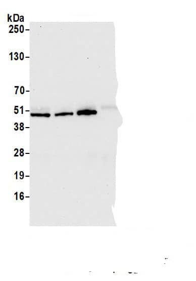 Immunoprecipitation:BCKDHA AntibodyNBP3-29784] -Detection of human BCKDHA by western blot of immunoprecipitates. Samples: Whole cell lysate (1.0 mg per IP reaction; 20% of IP loaded) from HEK293T cells prepared using NETN lysis buffer. Antibodies: Affinity purified rabbit anti-BCKDHA antibody NBP3-29784 (lot NBP3-29784-2) used for IP at 6 µg per reaction. BCKDHA was also immunoprecipitated by a previous lot of this antibody (lot NBP3-29784-1) and rabbit anti-BCKDHA.. For blotting immunoprecipitated BCKDHA, NBP3-29784 was used at 0.04 µg/ml. Detection: Chemiluminescence with an exposure time of 10 seconds.