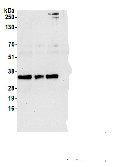 Immunoprecipitation:POLR2C AntibodyNBP3-29786] -Detection of human RPB3 by western blot of immunoprecipitates. Samples: Whole cell lysate (1.0 mg per IP reaction; 20% of IP loaded) from HEK293T cells prepared using NETN lysis buffer. Antibodies: Affinity purified rabbit anti-RPB3 antibody (NBP3-29786 lot 2) used for IP at 6 µg per reaction. RPB3 was also immunoprecipitated by a previous lot of this antibody (NBP3-29786 lot 1) and a second.inst a different epitope of RPB3. For blotting immunoprecipitated RPB3, NBP3-29786 was used at 0.04 µg/ml. Detection: Chemiluminescence with an exposure time of 30 seconds.