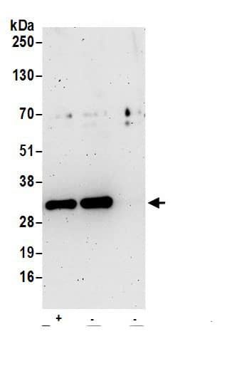 Immunoprecipitation:Stomatin AntibodyNBP3-29788] -Detection of human Stomatin by western blot of immunoprecipitates. Samples: Whole cell lysate (1 mg for IP; 20% of IP loaded) prepared using RIPA buffer from HeLa cells. Antibodies: Affinity purified rabbit anti-Stomatin antibody NBP3-29788 (lot NBP3-29788-1) used for IP at 6 µg per reaction. Stomatin was also immunoprecipitated by rabbit anti-Stomatin antibody. For blotting immunoprecipitated Stomatin, NBP3-29788 was used at 1 µg/ml. Detection: Chemiluminescence with an exposure time of 3 minutes.