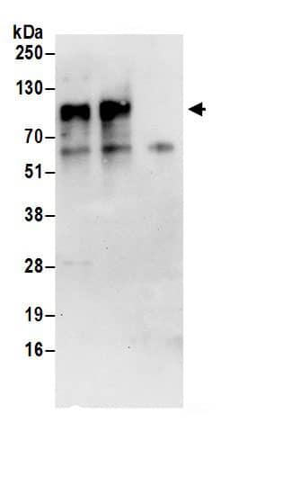 Immunoprecipitation:TGN38 AntibodyNBP3-29790] -Detection of human TGOLN2 by western blot of immunoprecipitates. Samples: Whole cell lysate (1 mg for IP; 20% of IP loaded) prepared using NETN buffer from 293T cells. Antibodies: Affinity purified rabbit anti-TGOLN2 antibody NBP3-29790 (lot NBP3-29790-1) used for IP at 6 µg per reaction. TGOLN2 was also immunoprecipitated by rabbit anti-TGOLN2.. For blotting immunoprecipitated TGOLN2, NBP3-29790 was used at 1 µg/ml. Detection: Chemiluminescence with an exposure time of 30 seconds.