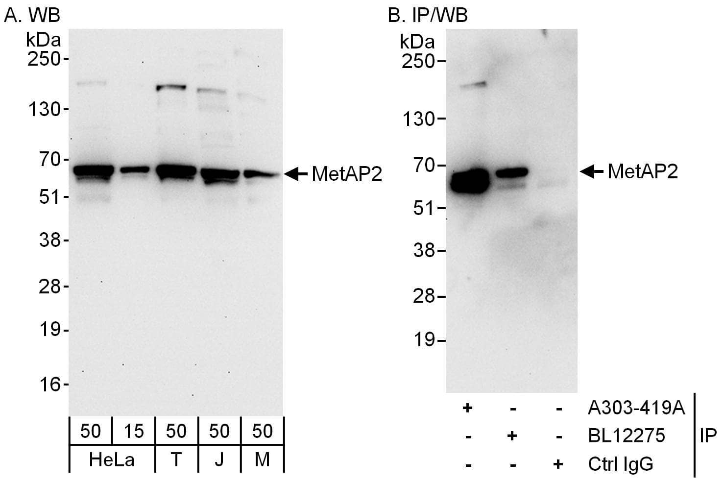 Western Blot:[NBP3-29791]-Detection of human and mouse MetAP2 by western blot and immunoprecipitation. Samples: Whole cell lysate from HeLa , HEK293T , Jurkat and mouse NIH 3T3 cells. Antibodies: Affinity purified rabbit anti-MetAP2 antibody used for WB at 0. 1 µg/ml and 1 µg/ml and used for IP at 6 µg/mg lysate. MetAP2 was also immunoprecipitated by rabbit anti-MetAP2 antibody , which recognizes a downstream epitope. Detection: Chemiluminescence with exposure times of 30 seconds and 10 seconds.