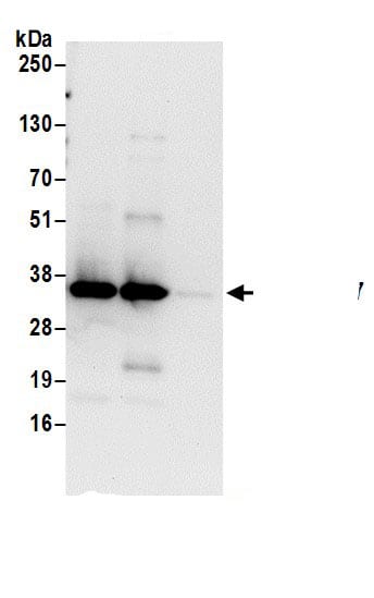 Immunoprecipitation:Syntaxin 7 AntibodyNBP3-29794] -Detection of human Syntaxin 7 by western blot of immunoprecipitates. Samples: Whole cell lysate (0.5 or 1.0 mg per IP reaction; 20% of IP loaded) from 293T cells prepared using RIPA lysis buffer. Antibodies: Affinity purified rabbit anti-Syntaxin 7 antibody NBP3-29794 (lot NBP3-29794-1) used for IP at 6 µg per reaction. Syntaxin 7 was also immunoprecipitated by rabbit anti-Syntaxin 7 antibody BL17058. For blotting immunoprecipitated Syntaxin 7, NBP3-29794 was used at 1 µg/ml. Detection: Chemiluminescence with an exposure time of 30 seconds.