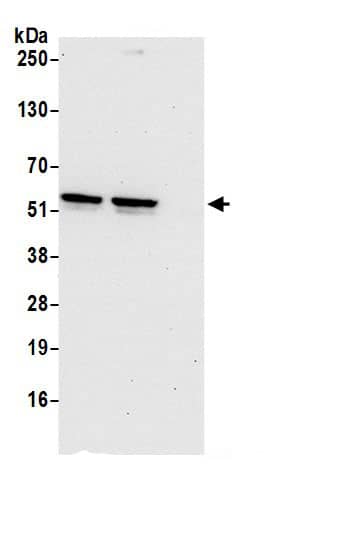 Immunoprecipitation:TSPYL1 AntibodyNBP3-29795] -Detection of human TSPYL1 by western blot of immunoprecipitates. Samples: Whole cell lysate (0.5 or 1.0 mg per IP reaction; 20% of IP loaded) from 293T cells prepared using NETN lysis buffer. Antibody: Affinity purified rabbit anti-TSPYL1 antibody NBP3-29795 (lot NBP3-29795-1) used for IP at 6 µg per reaction. TSPYL1 was also immunoprecipitated by rabbit anti-TSPYL1 antibody. For blotting immunoprecipitated TSPYL1, NBP3-29795 was used at 1 µg/ml. Detection: Chemiluminescence with an exposure time of 30 seconds.