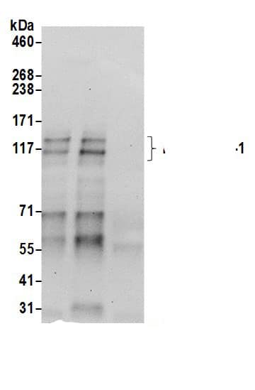 Immunoprecipitation:HA-1 AntibodyNBP3-29796] -Detection of human HMHA1/HA-1 by western blot of immunoprecipitates. Samples: Whole cell lysate (0.5 or 1.0 mg per IP reaction; 20% of IP loaded) from Jurkat cells prepared using NETN lysis buffer. Antibodies: Affinity purified rabbit anti-HMHA1/HA-1 antibody NBP3-29796 (lot NBP3-29796-1) used for IP at 6 µg per reaction. HMHA1/HA-1 was also immunoprecipitated by rabbit anti-HMHA1/HA-1.. For blotting immunoprecipitated HMHA1/HA-1, NBP3-29796 was used at 0.4 µg/ml. Detection: Chemiluminescence with an exposure time of 30 seconds.