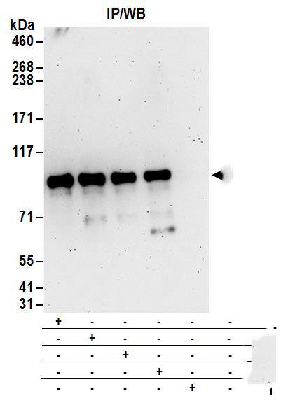 Immunoprecipitation:[NBP3-29797]-Detection of human DIXDC1 by western blot of immunoprecipitates. Samples: Whole cell lysate from 293T cells. Antibodies: Affinity purified rabbit anti-DIXDC1 antibody used for IP at 6 µg/mg lysate. DIXDC1 was also immunoprecipitated by rabbit anti-DIXDC1 antibodies , and. For blotting immunoprecipitated DIXDC1, was used at 1 µg/ml. Detection: Chemiluminescence with an exposure time of 3 minutes.