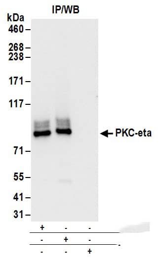 Immunoprecipitation:[NBP3-29798]-Detection of human PKC-eta by western blot of immunoprecipitates. Samples: Whole cell lysate from Jurkat cells. Antibodies: Affinity purified rabbit antibody used for IP at 6 µg/mg lysate. PKC-eta was also immunoprecipitated by rabbit antibody. For blotting immunoprecipitated PKC-eta, was used at 1 µg/ml. Detection: Chemiluminescence with an exposure time of 3 seconds.