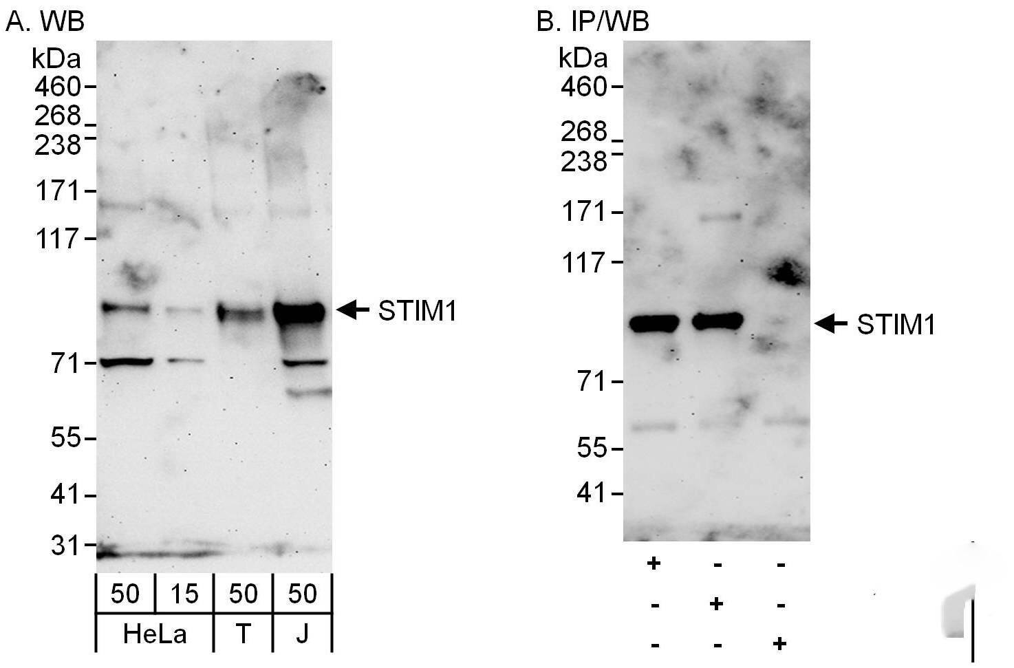 Western Blot:[NBP3-29799]-Detection of human STIM1 by western blot and immunoprecipitation. Samples: Whole cell lysate from HeLa , HEK293T and Jurkat cells. Antibodies: Affinity purified rabbit anti-STIM1 antibody used for WB at 0. 4 µg/ml and 1 µg/ml and used for IP at 6 µg/mg lysate. STIM1 was also immunoprecipitated by rabbit anti-STIM1 antibody , which recognizes an upstream epitope. Detection: Chemiluminescence with exposure times of 3 minutes.