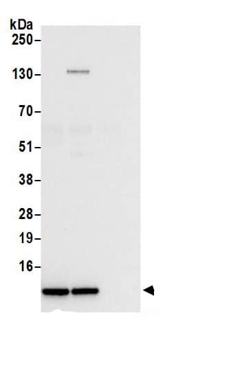 Immunoprecipitation:RPL38 AntibodyNBP3-29800] -Detection of human RPL38 by western blot of immunoprecipitates. Samples: Whole cell lysate (0.5 or 1.0 mg per IP reaction; 20% of IP loaded) from 293T cells prepared using NETN lysis buffer. Antibodies: Affinity purified rabbit anti-RPL38 antibody NBP3-29800 (lot NBP3-29800-1) used for IP at 6 µg per reaction. RPL38 was also immunoprecipitated by rabbit anti-RPL38 antibody BL21442. For blotting immunoprecipitated RPL38, NBP3-29800 was used at 1 µg/ml. Detection: Chemiluminescence with an exposure time of 3 seconds.