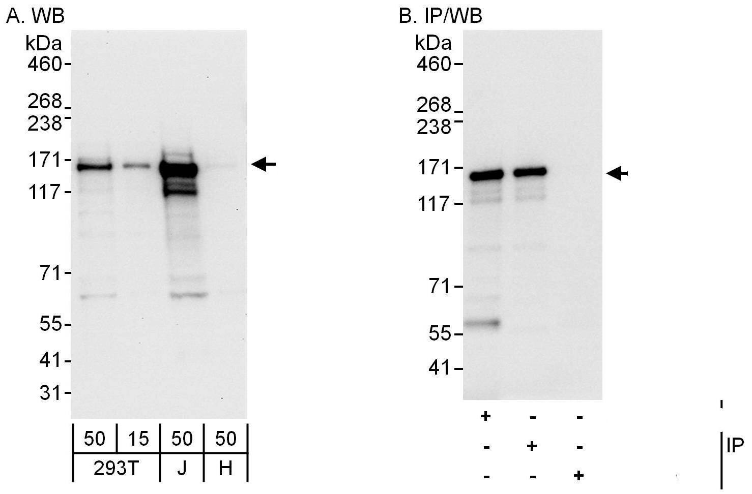 Western Blot:[NBP3-29802]-Detection of human Cingulin by western blot and immunoprecipitation. Samples: Whole cell lysate from HEK293T , Jurkat and HeLa cells. Antibodies: Affinity purified rabbit anti-Cingulin antibody used for WB at 0. 1 µg/ml and 1 µg/ml and used for IP at 6 µg/mg lysate. Cingulin was also immunoprecipitated by rabbit anti-Cingulin antibody , which recognizes a downstream epitope. Detection: Chemiluminescence with exposure times of 10 seconds and 3 seconds.