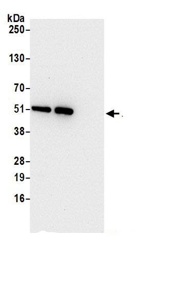 Immunoprecipitation:ETEA AntibodyNBP3-29803] -Detection of human FAF2 by western blot of immunoprecipitates. Samples: Whole cell lysate (0.5 or 1.0 mg per IP reaction; 20% of IP loaded) from 293T cells prepared using NETN lysis buffer. Antibodies: Affinity purified rabbit anti-FAF2 antibody NBP3-29803 (lot NBP3-29803-1) used for IP at 6 µg per reaction. FAF2 was also immunoprecipitated by rabbit anti-FAF2.. For blotting immunoprecipitated FAF2, NBP3-29803 was used at 0.4 µg/ml. Detection: Chemiluminescence with an exposure time of 10 seconds.