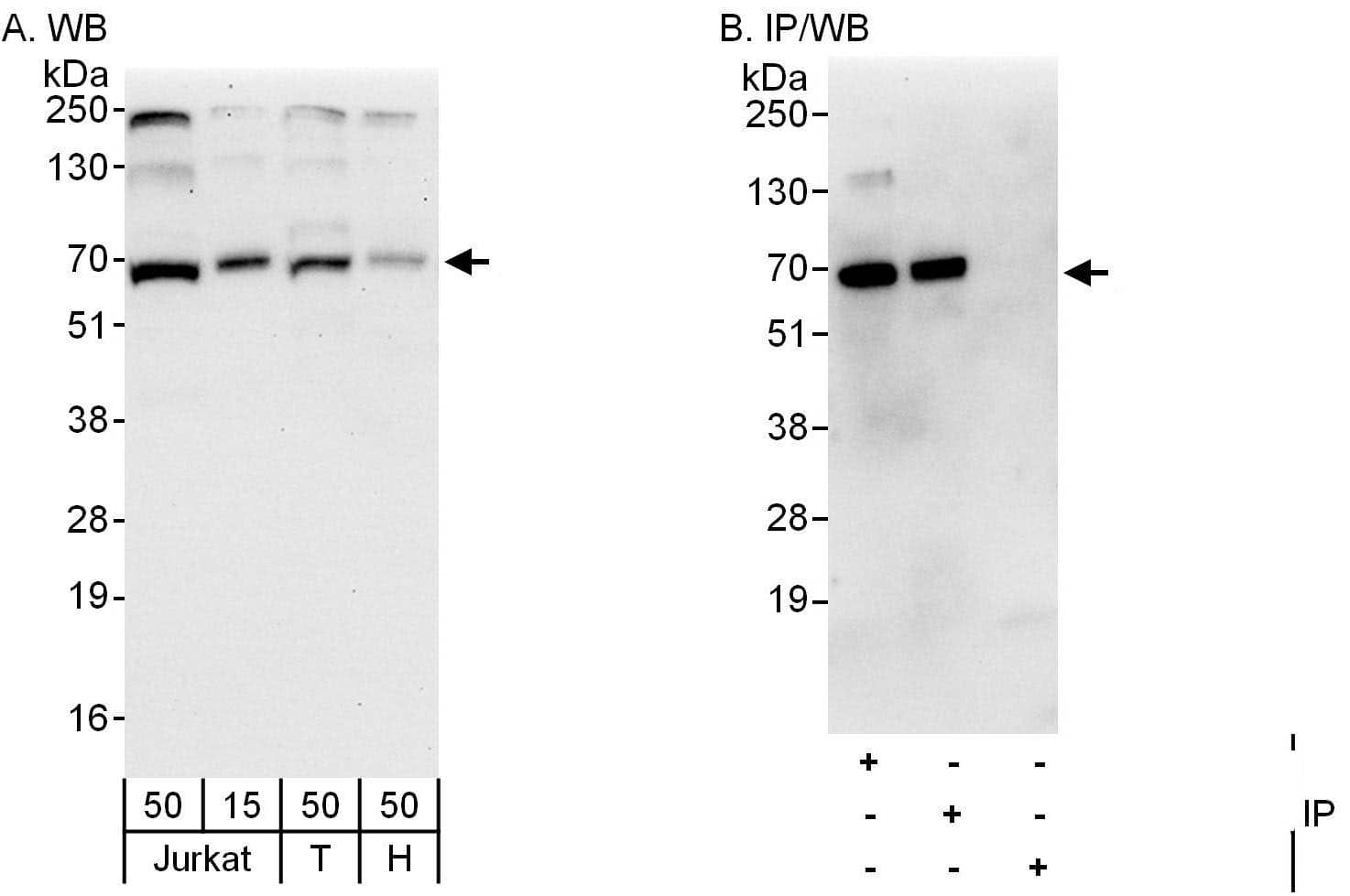 Western Blot:[NBP3-29806]-Detection of human Atlastin2 by western blot and immunoprecipitation. Samples: Whole cell lysate from Jurkat , HEK293T and HeLa cells. Antibodies: Affinity purified rabbit anti-Atlastin2 antibody used for WB at 0. 04 µg/ml and 0. 4 µg/ml and used for IP at 6 µg/mg lysate. Atlastin2 was also immunoprecipitated by rabbit anti-Atlastin2 antibody , which recognizes a downstream epitope. Detection: Chemiluminescence with exposure times of 30 seconds and 10 seconds.