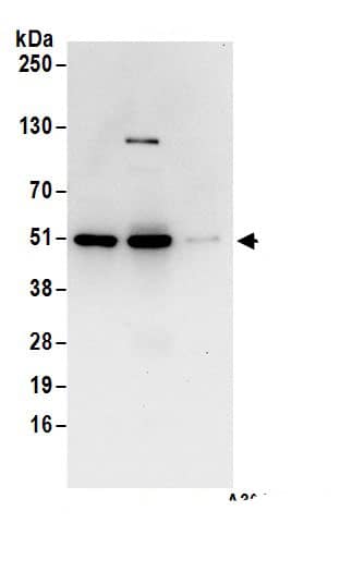 Immunoprecipitation:CSK AntibodyNBP3-29807] -Detection of human CSK by western blot of immunoprecipitates. Samples: Whole cell lysate (1 mg for IP; 20% of IP loaded) from Jurkat cells. Antibodies: Affinity purified rabbit anti-CSK antibody NBP3-29807 (lot NBP3-29807-1) used for IP at 6 µg/mg lysate. CSK was also immunoprecipitated by rabbit anti-CSK.. For blotting immunoprecipitated CSK, NBP3-29807 was used at 1 µg/ml. Detection: Chemiluminescence with an exposure time of 10 seconds.